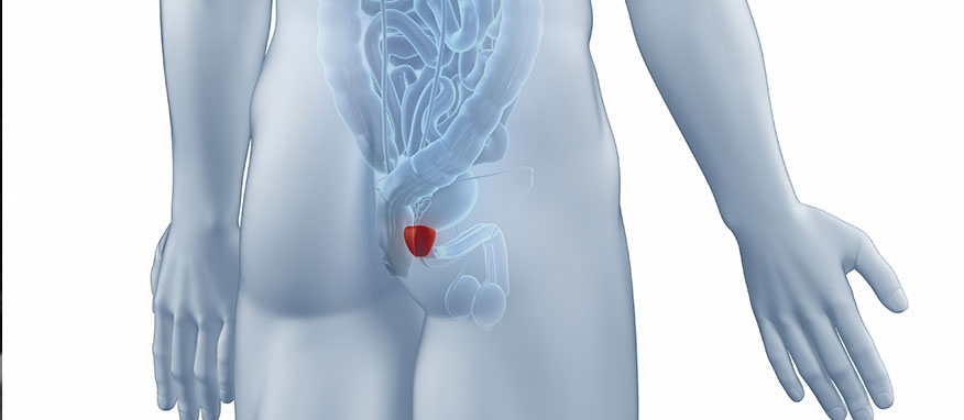 Ressecção endoscópica da próstata